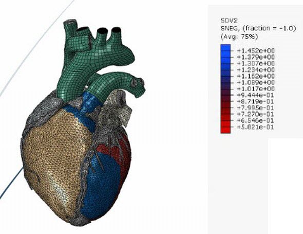 Simulace infarktu myokardu