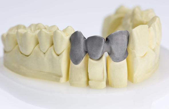 3D tisk kovů se s úspěchem využívá v medicíně při výrobě dentálních náhrad