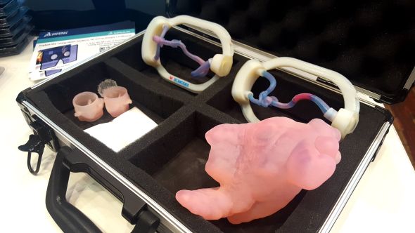 O 3D tisk orgánů se již firmy pokouší. Materiály prozatím nesplňují biologické požadavky. Foto: Marek Pagáč